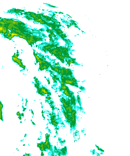 Niederschlagsradar