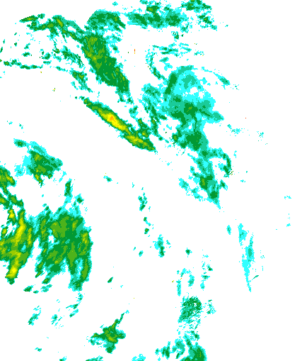 Niederschlagsradar