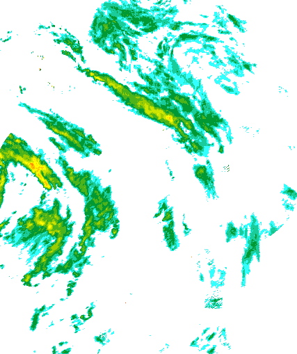 Niederschlagsradar