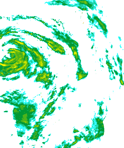 Niederschlagsradar