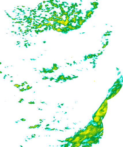 Niederschlagsradar