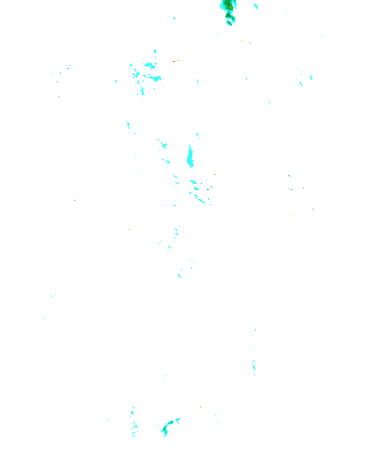 Niederschlagsradar
