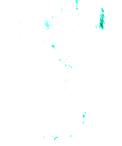 Niederschlagsradar