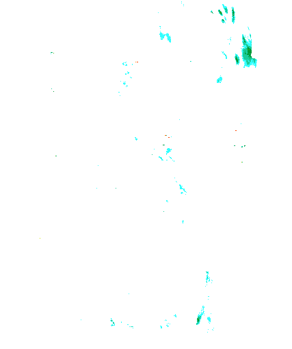 Niederschlagsradar
